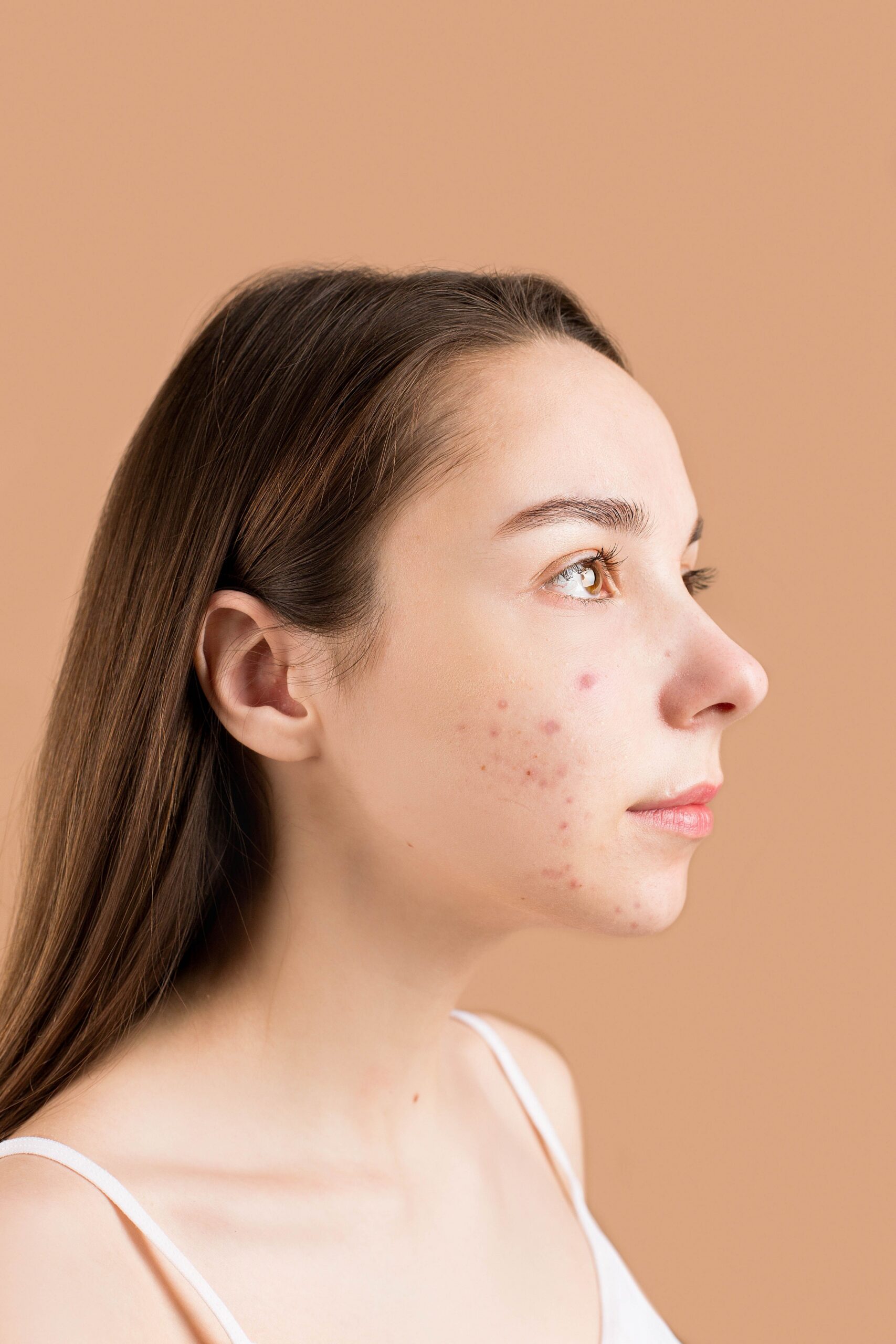 Dermatologo konsultacija klinikoje